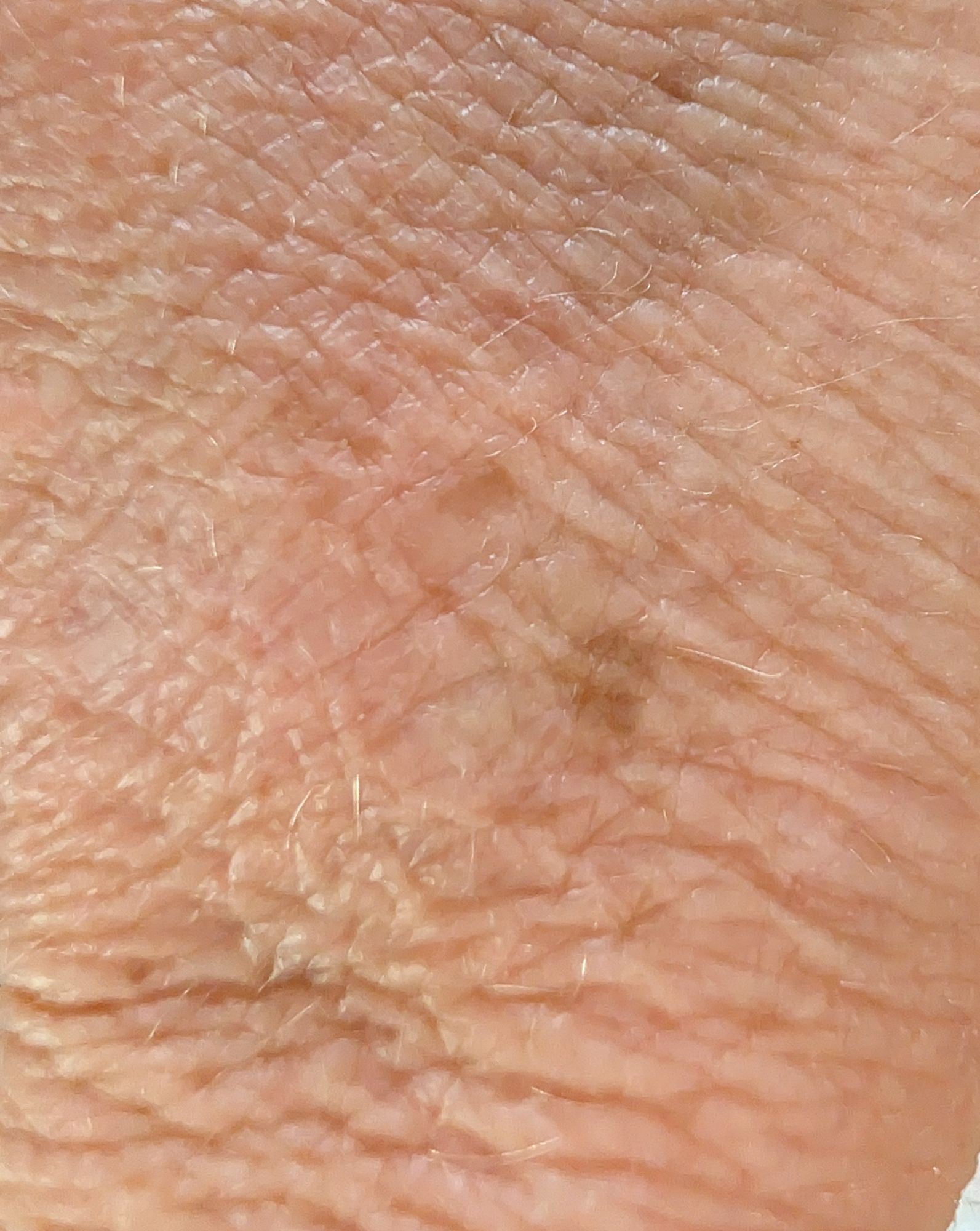 Marguerite's skin magnified, before The Crème
