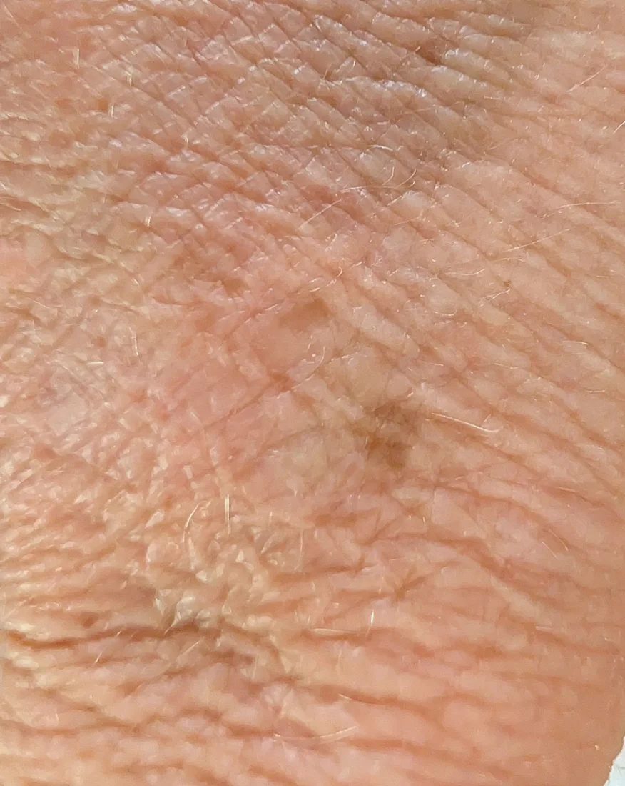 Marguerite's skin magnified, before The Peptide Crème